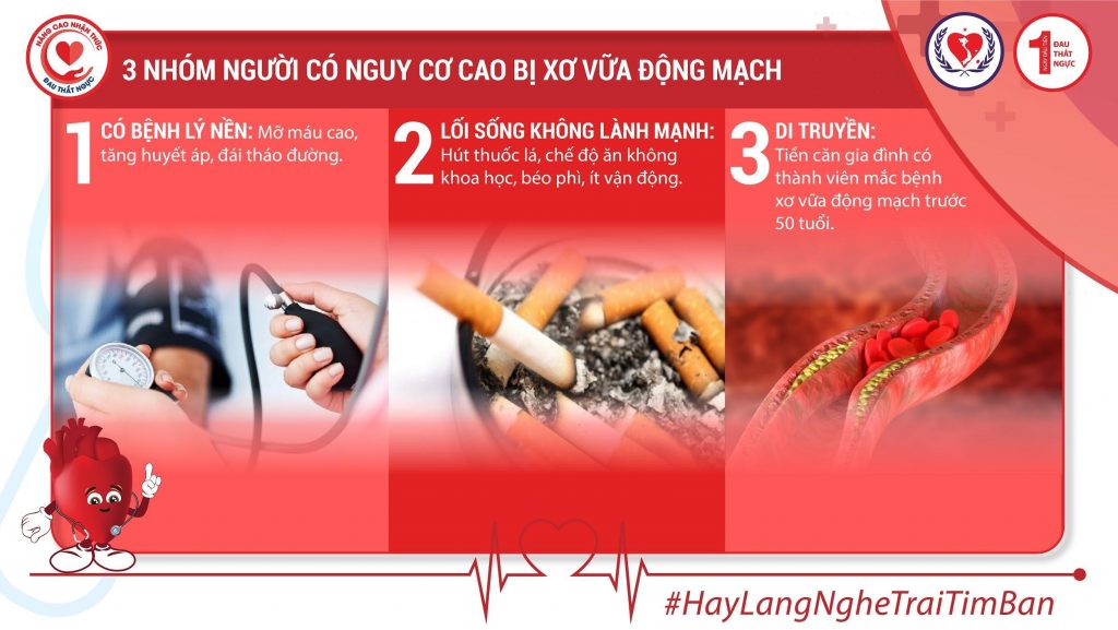 Nhóm người có nguy cơ cao bị xơ vữa động mạch