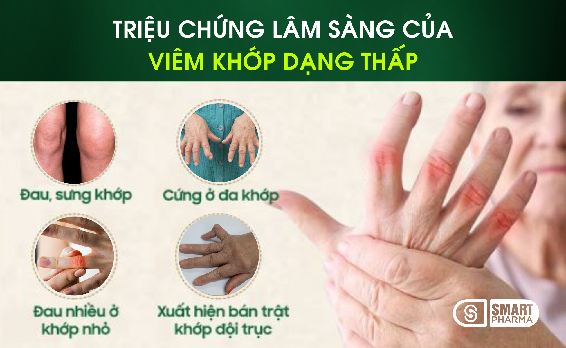 Triệu chứng điển hình của viêm khớp dạng thấp