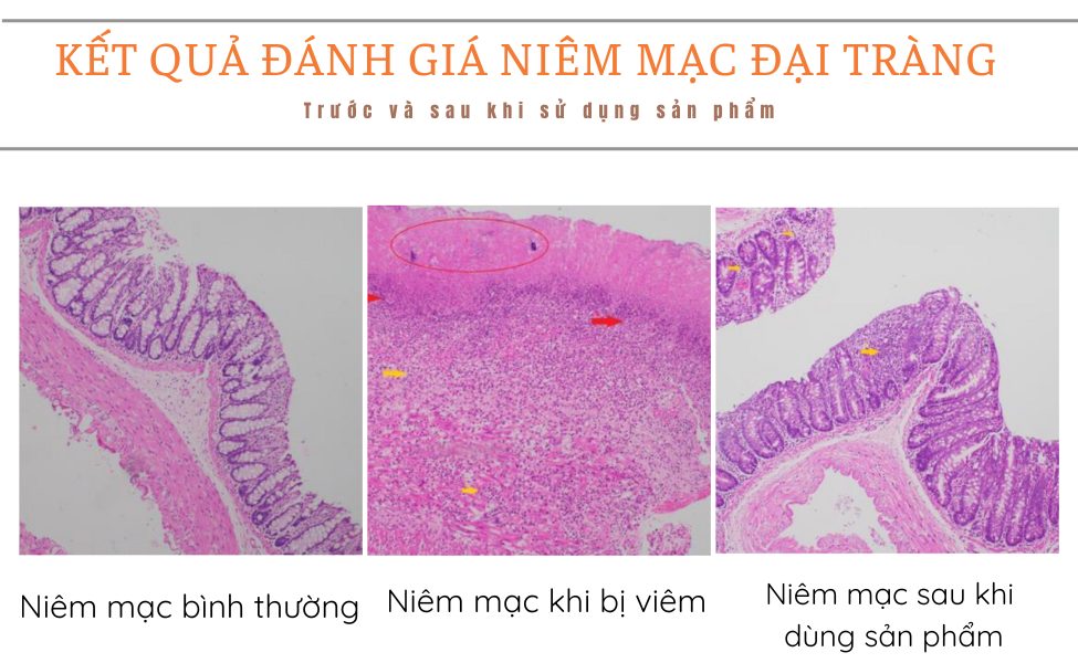 Smart Pharma - tac dung giam phu ne