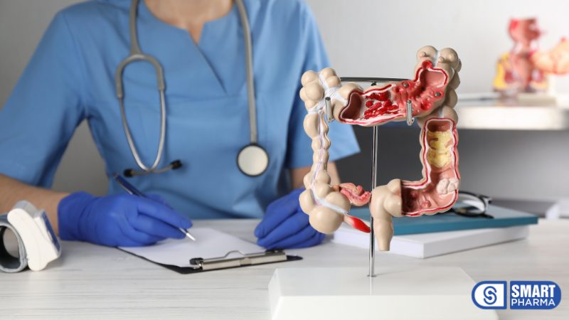 Ung thư đại tràng là bệnh khá phổ biến ở Việt Nam