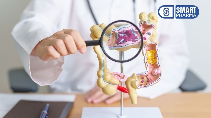 Smart Pharma - Stress có thể kích hoạt hội chứng ruột kích thích 3 việc tự chẩn đoán mà không có sự đánh giá y tế chuyên môn có thể dẫn đến nhầm lẫn nghiêm trọng với các bệnh lý khác nguy hiểm hơn