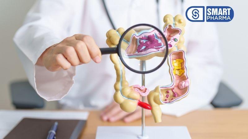 Smart Pharma - Stress có thể kích hoạt hội chứng ruột kích thích 3 việc tự chẩn đoán mà không có sự đánh giá y tế chuyên môn có thể dẫn đến nhầm lẫn nghiêm trọng với các bệnh lý khác nguy hiểm hơn