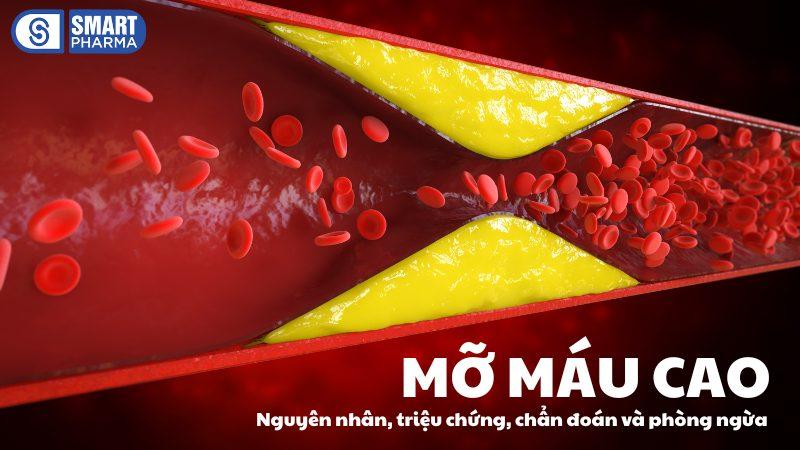 Smart Pharma - Mỡ máu cao: Nguyên nhân, triệu chứng, chẩn đoán và phòng ngừa 1 Smart Pharma - 1 1