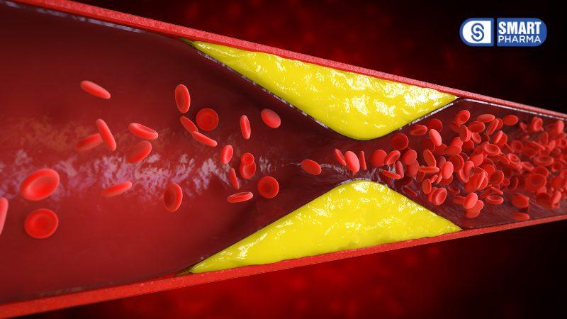 Smart Pharma - Đàn ông yếu sinh lý vì chính những thói quen thường ngày này 5 Smart Pharma - 2