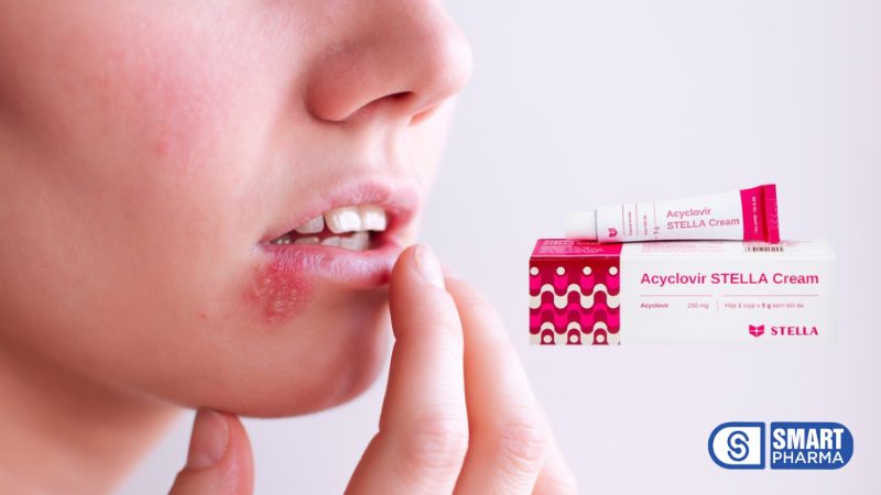 Smart Pharma - Viêm kết mạc mắt: Nguyên nhân, triệu chứng và cách điều trị hiệu quả 5 Smart Pharma - 7