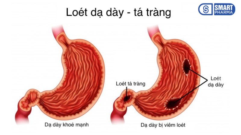 Smart Pharma - Chào mừng bạn đến với Nhà Thuốc SMART PHARMA 1 Smart Pharma - 9 1